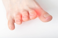 What to Do About a Pinched Foot Nerve