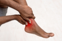 How Psoriatic Arthritis Affects the Feet